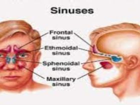 How to Get Rid of a Sinus Infection in 24 Hours