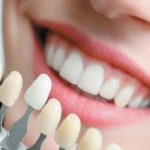 Significant Benefits of Having Cosmetic Dentistry